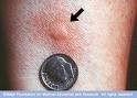 Allergy Testing Allergy Testing