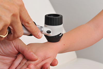 Skin Cancer Canton, GA Skin Cancer Canton, GA